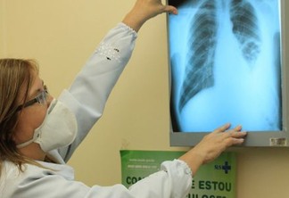 conselho-aprova-novas-diretrizes-para-tratamento-da-tuberculose-no-sus
