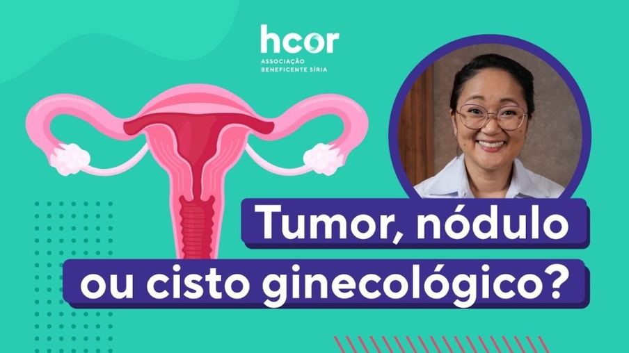 Hcor Explica: como diferenciar tumor, cisto e nódulo ginecológico?