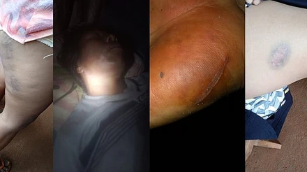 Indígenas que participaram de retomada da área sobreposta pela Fazenda Maringá mostram ferimentos do ataque de jagunços - Comunidade Pyelito Kue