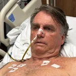 Cirurgia de Jair Bolsonaro será neste domingo: o que se sabe sobre o procedimento | Diário Carioca Jair Bolsonaro - Foto: Reprodução